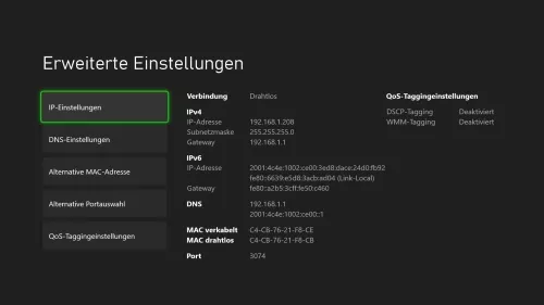 Xbox Xbox IP-Einstellungen